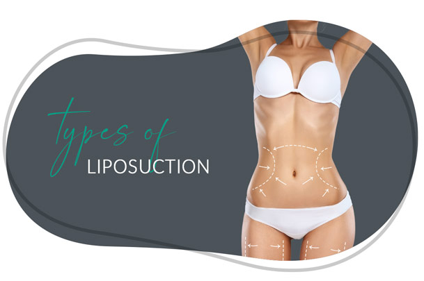 liposuction -dr-hanna-ventura-county